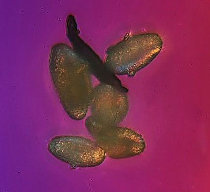 北京霾颗粒放大1000倍-看上去真的触目惊心4