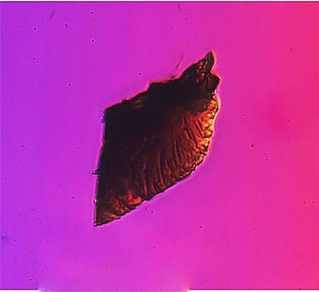 北京霾颗粒放大1000倍-看上去真的触目惊心3