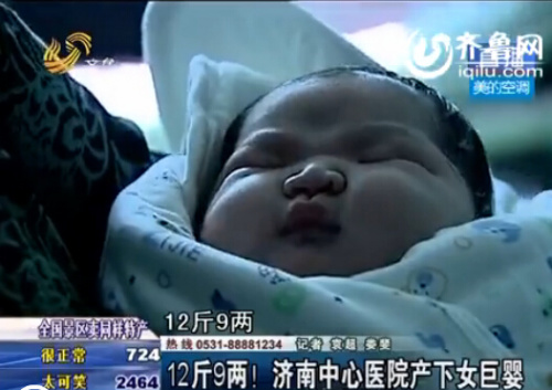 12斤9两女巨婴(视频截图) 12斤9两女巨婴(视频截图)