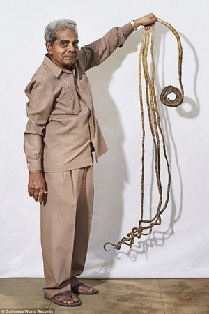 1952年，也就是从Shridhar16岁的时候开始，他就再也没有剪过左手上的指甲，这一手指甲留了整整62年。现在最长的是拇指指甲，长达2米，其次分别是1米86的中指指甲、1米81的无名指指甲、1米79的小指指甲和1米64的食指指甲。