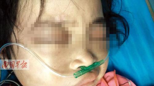 　　7岁女童全身是伤下体撕裂出血续：姑父已被刑拘