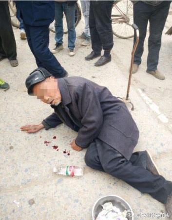80岁老人吐血行乞真相曝光 网友：老人是演技派