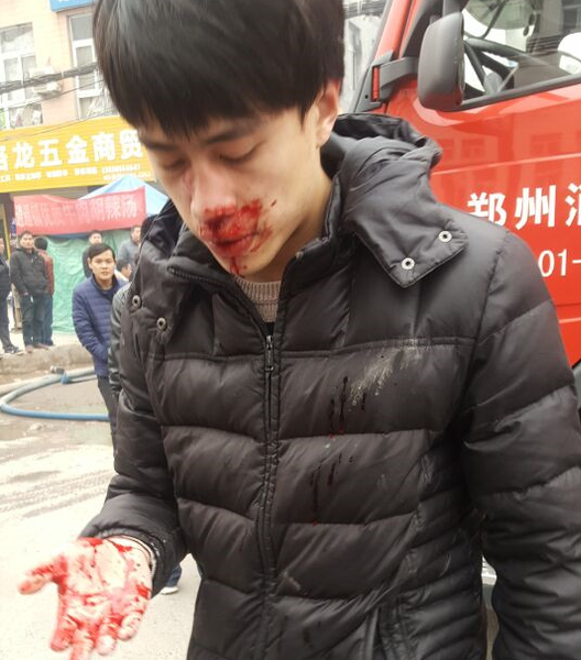 河南电视台记者被打伤