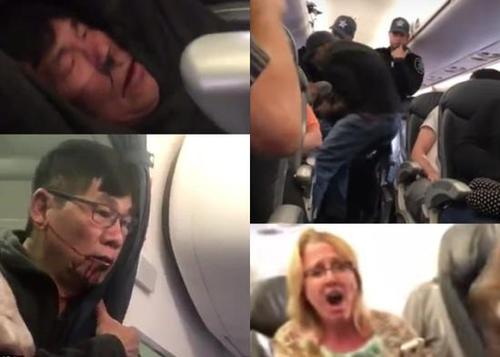 满脸是血!美联航超额订票暴力赶客 华人乘客被强行拖走