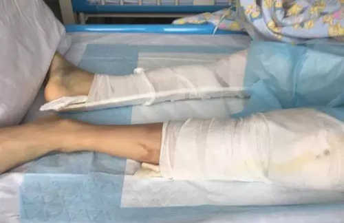 13岁男孩玩网游被骂而跳楼 刚苏醒:我要登录账号