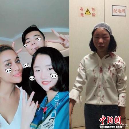  图为当事人提供的被打前后对比图。　网络图