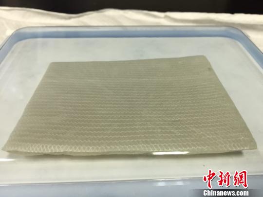 中国强化型人工真皮产品进入临床试验有望打破国际垄断