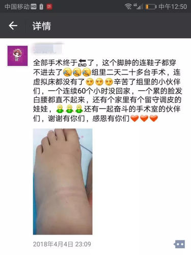 女子发照片晒自己丑丑的大象脚 却感动了朋友圈