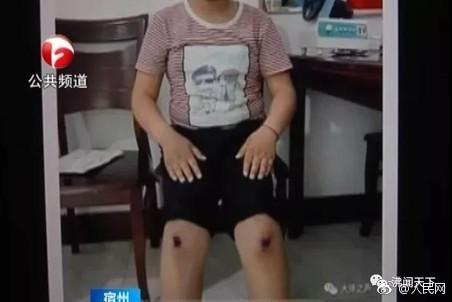 老师让小学生操场跪爬致伤 校方:涉事老师已停职