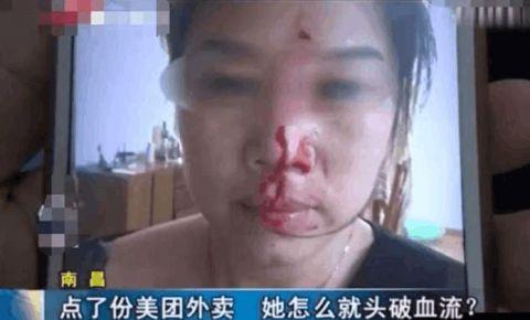 女子点外卖被打得头破血流 外卖小哥:赔钱也要打你