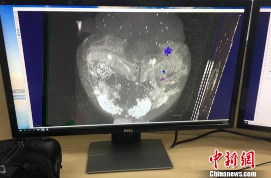 东南大学成立脑科学与智能技术研究院：探索人类“终极疆域”