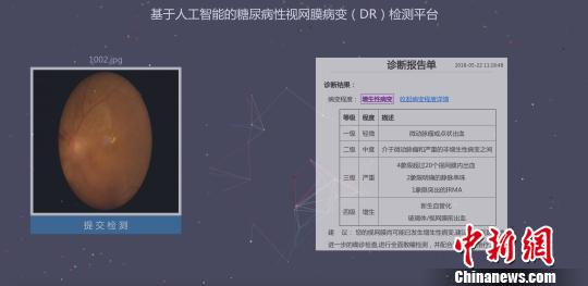 湖南大学学生借助人工智能筛查糖网病