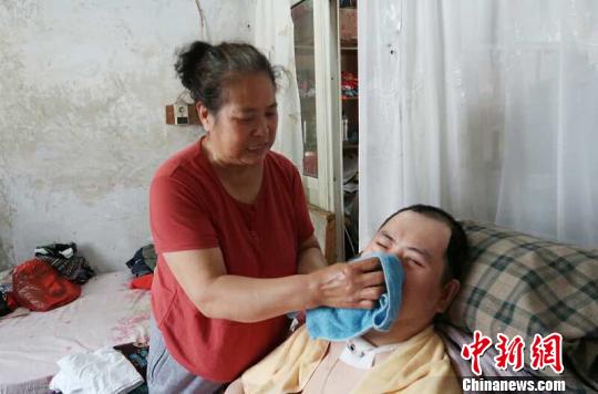 每次喂完食物后，梁青兰都要仔细地帮儿子清理干净。　尚明侠 摄