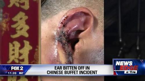 美国女食客对中餐馆食物不满意 一口咬破老板耳朵