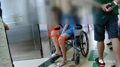 女子深夜醉卧路边被人带到酒店 被找到时多处淤青