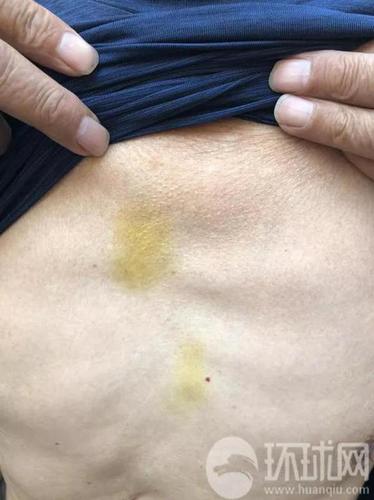 去瑞典中国游客:有失去理智的举动 但这不是撒泼