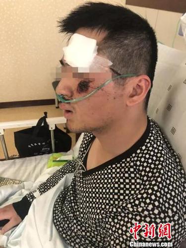 图为张晓达。 秀洲公安供图 摄 图为张晓达。 秀洲公安供图 摄