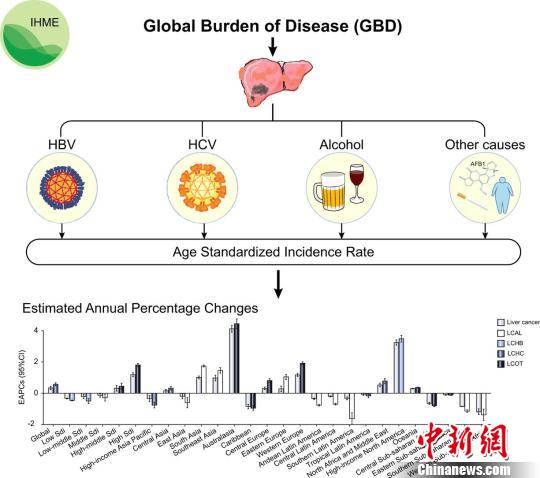 全球不同地区肝癌发病模式及主要病因存在显著差异。　研究示意图 摄
