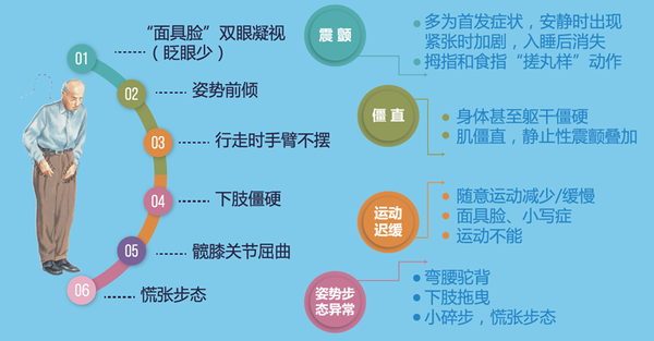 帕金森病症状表现