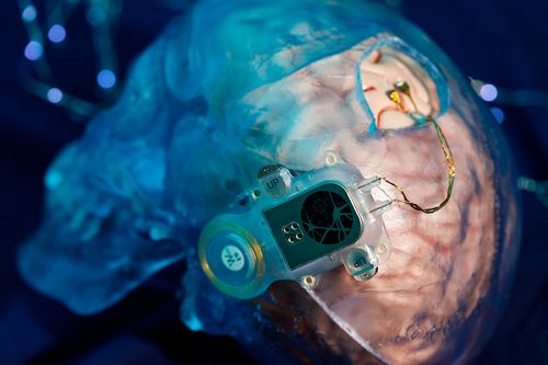 新型脑机接口最新临床前神经数据公布