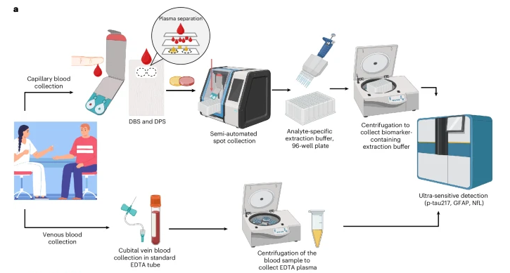 阿尔茨海默病可从指血验出