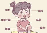 中医支招：夏季湿疹、蚊虫叮咬防治全攻略