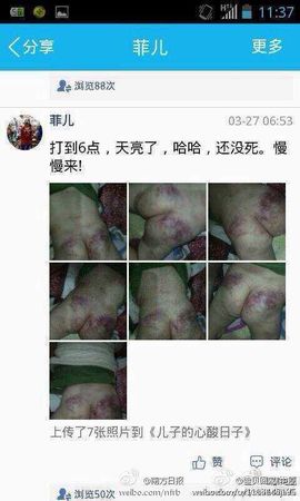 网晒虐子照3