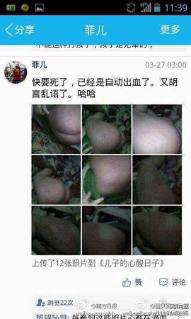 网晒虐子照