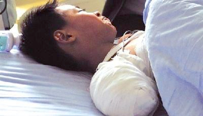 男童被黑熊咬掉右臂后安慰家人：以后能练左手2