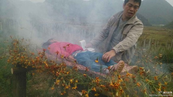火熏治疗5