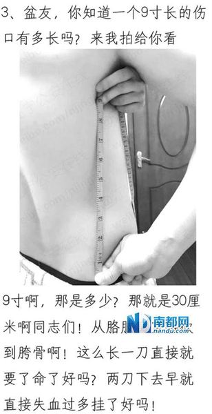 @江宁公安在线 博主裸上身示范“9寸伤口”的长度，引发关注并获网友点赞。 微博截图