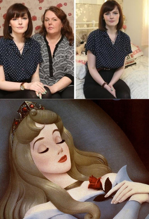 英20岁少女患“睡美人综合征”-全世界千人患此症2
