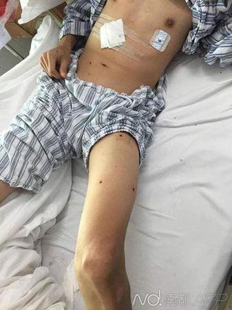 中枪伤者躺在病床上。