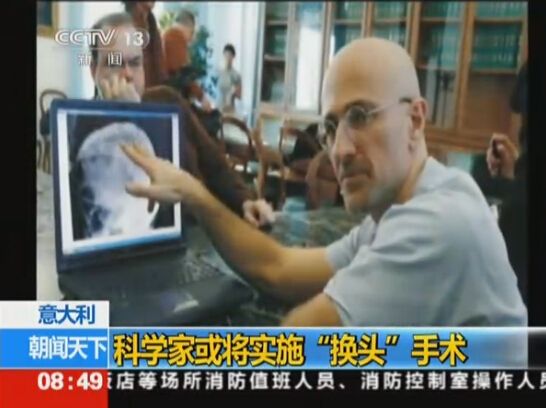 首例人类“换头”手术将实施：比死还难受