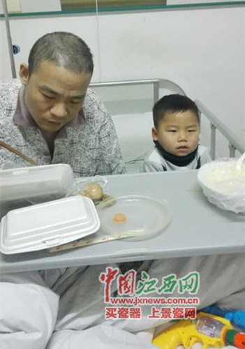 在化疗期间，沈志勇的头发几乎全部掉光