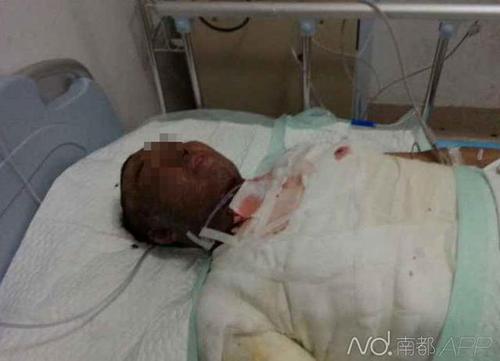 伤者正在医院接受治疗