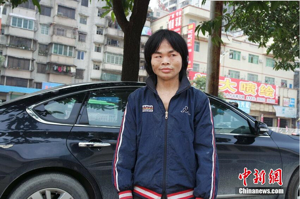 男子遭黑作坊囚禁18年后获救4