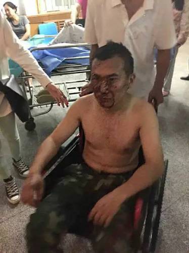 受伤消防士兵被送到医院后只说了一句话：