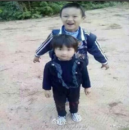 兄妹被人强灌硫酸女童惨死 男童被腐蚀皮肤黑青面目全非
