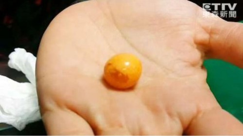 椰子螺吐出美乐珠，图为老板娘捡到的美乐珠