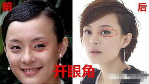 孙俪被导演赞用生命演戏，这次孙俪自曝整过容，这算不算也是用生命在演戏？