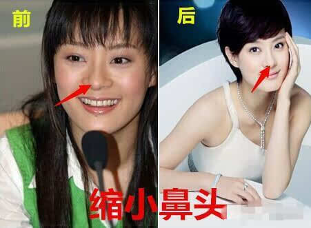 孙俪被导演赞用生命演戏，这次孙俪自曝整过容，这算不算也是用生命在演戏？1