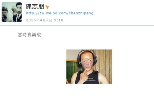 陈志朋晒脸部严重烧伤旧照自称当时真勇敢（图）