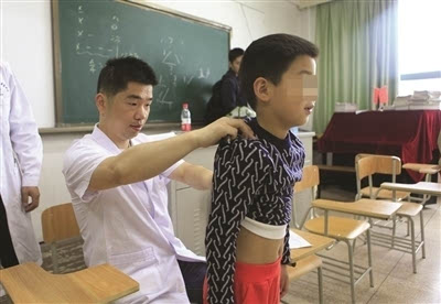 专业骨科医生依次为孩子做脊柱侧弯筛查