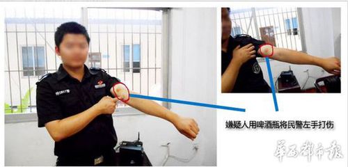 警察手上的伤
