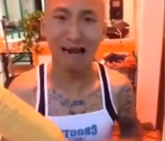 男子表示从来没想到会是这个结果的，看到自己上下门牙掉光后几乎处于崩溃边缘。