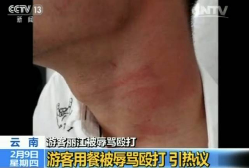 点击进入下一页