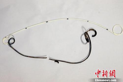 从成先生体内取出的导管，已变成黑色。　钟欣 摄