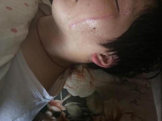男生与同学产生口角被按地上刀割双脸 老师不在场