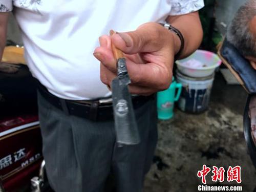 熊高武展示洗眼所用的工具。　吕杨 摄